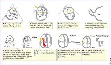 d sign on pocus.